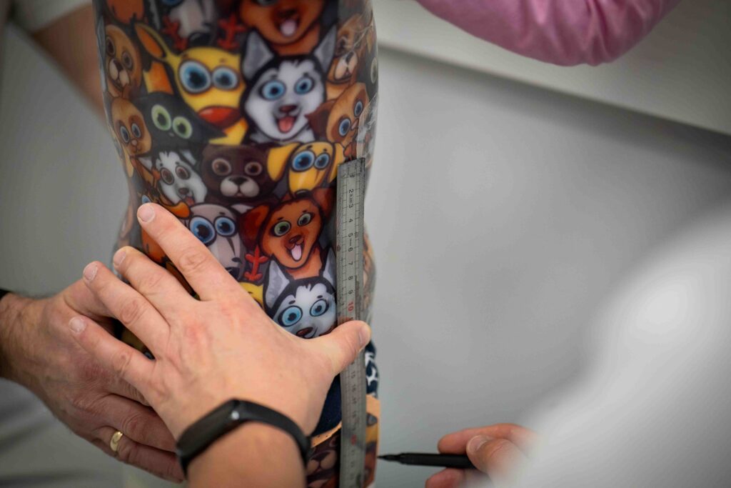 Przymiarka ortezy HKAFO